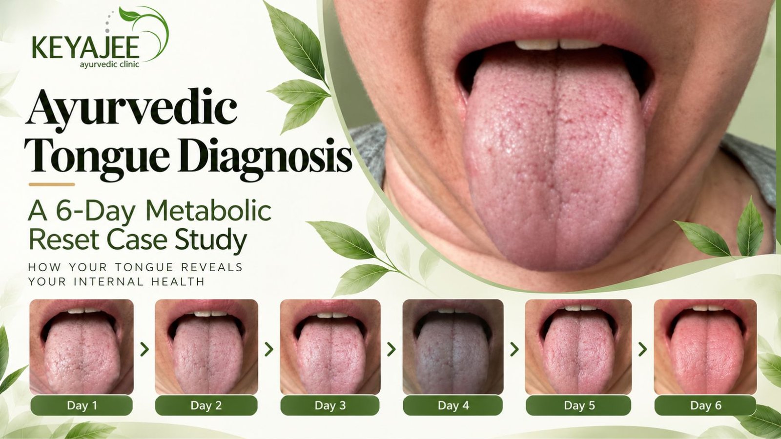 Ayurvedic Tongue Diagnosis: 6-Day Metabolic Reset