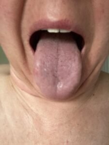 Day 5 — Improved Moisture, Hydration Restoring