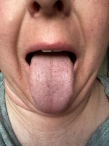 Day 6 — Metabolically Restored, Doshas Balanced